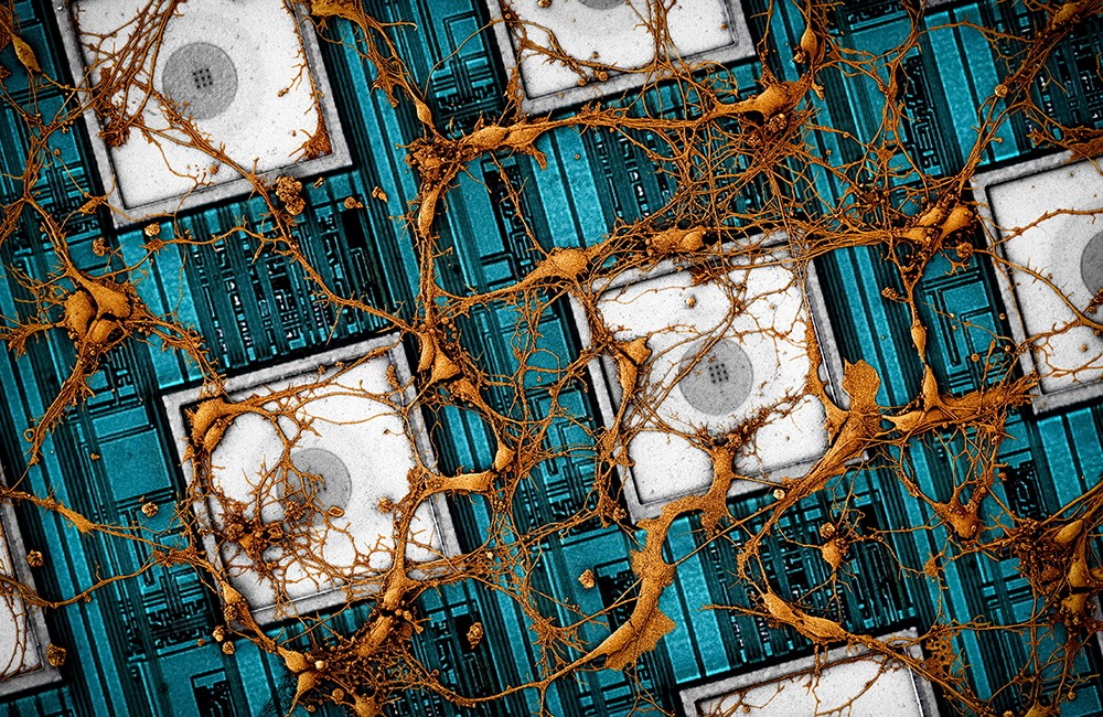 Images of rat neurons in the nanoelectrode array (Photo: clone/samsung)