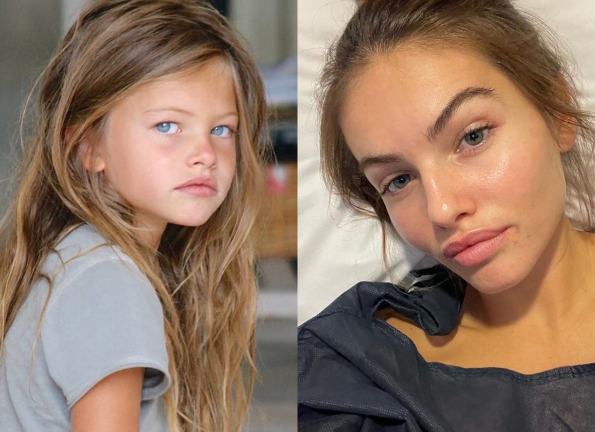 Thylane Blondeau undergoes surgery (Image: Engage/Instagram)